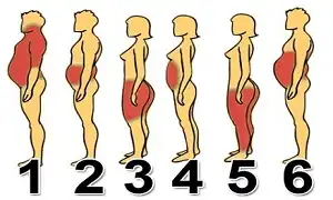 Bạn thuộc béo nhóm nào tùy thuộc vào lượng mỡ tích tụ ở đâu