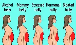 Các dạng tích mỡ bụng và giải pháp xử lý