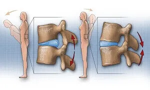 Cẩn thận với tổn thương lưng vì nó là nguyên nhân tạo ra nhiều chấn thương khác