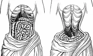 Đai nịt bụng lợi ít hại sức khỏe nhiều