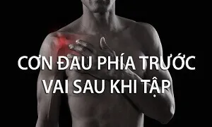 Đau phía trước vai sau khi tập do nguyên nhân gì và cách khắc phục nó