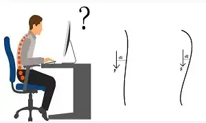 Gù lưng trên tốt hay xấu
