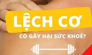 Lệch cơ có gây hại cho sức khoẻ không