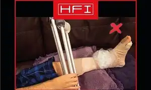 Ngưng ngay việc chườm đá khi chấn thương