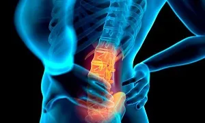 Nhóm cơ nào có thể gây ra vấn đề đau lưng