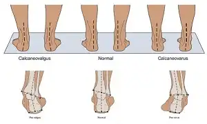 Tư thế đúng của đầu gối