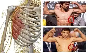 Vài dòng về cơ răng cưa phía trước hay Serratus Anterior