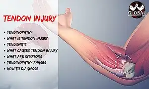 Vật tay - Trò chơi nguy hiểm không an toàn