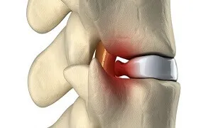 Vì sao bạn đau lưng và cách phòng chống cũng như chữa trị