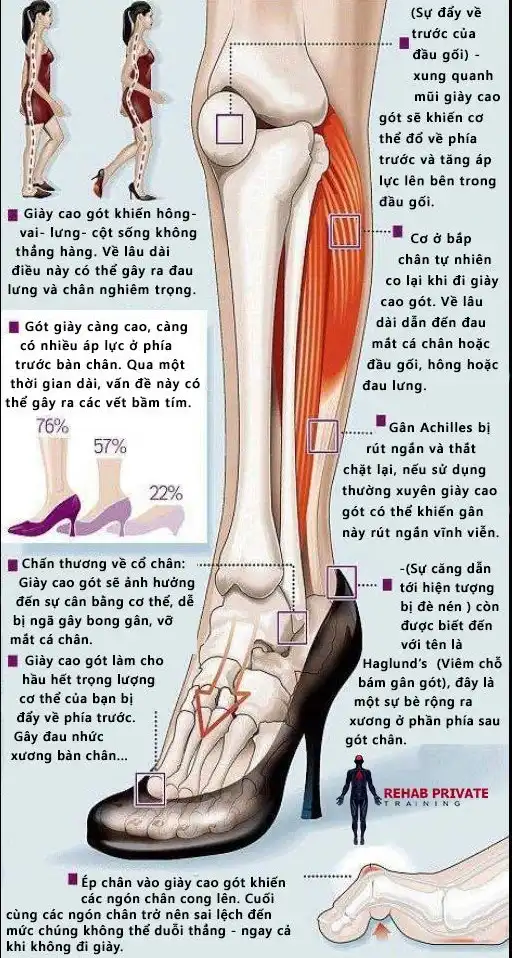 Ảnh hưởng của giày cao gót đến cơ thể