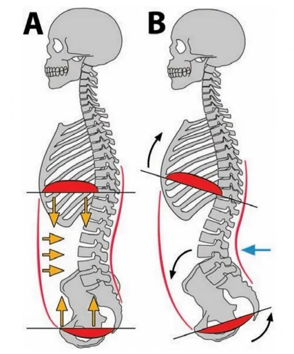 Bụng to vì Posture xấu hay phần lưng dưới bị võng Bụng to vì Posture xấu hay phần lưng dưới bị võng