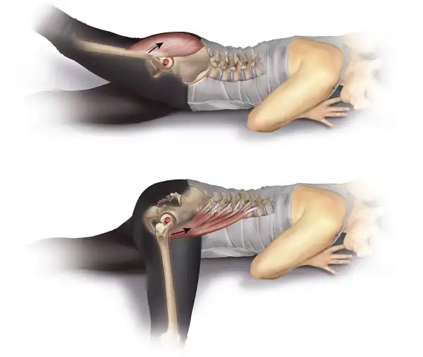 Cách cơ thể hoạt động khi bị căng cơ mông Cách cơ thể hoạt động khi bị căng cơ mông