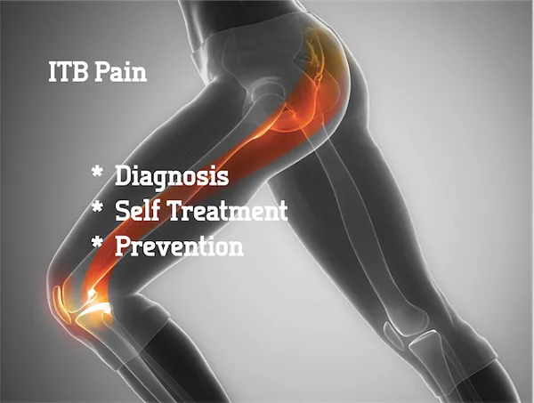 Chẩn đoán, điều trị và ngăn ngừa hội chứng IT Band Chẩn đoán, điều trị và ngăn ngừa hội chứng IT Band