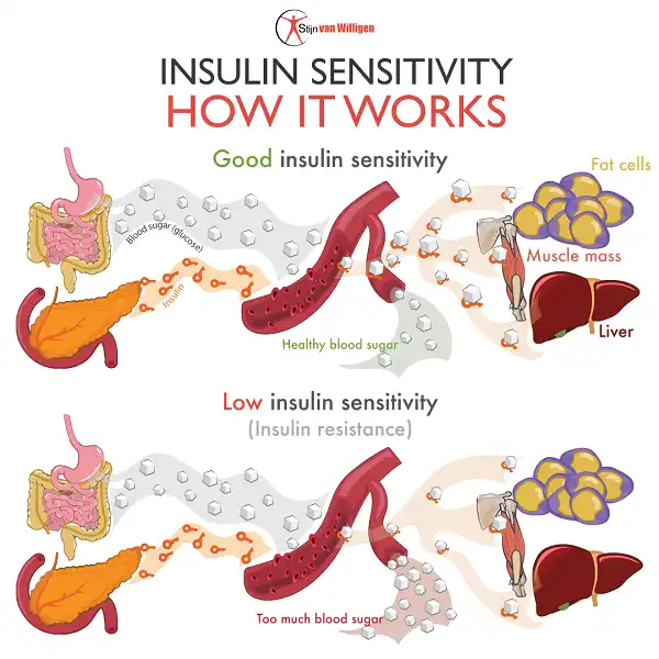 Quan tâm đến độ nhậy Insulin thay vì cứ giảm tinh bột trong chế độ ăn