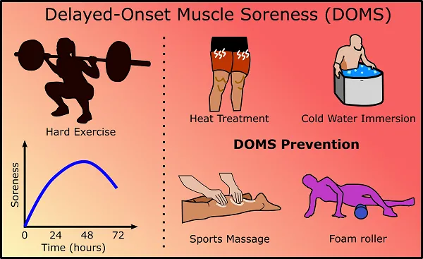 Hiện tượng nhức mỏi cơ gián đoạn (DOMS) sẽ xuất hiện dưới dạng các cơn đau và căng cứng cơ trong vòng 24-72 tiếng sau khi tập Hiện tượng nhức mỏi cơ gián đoạn (DOMS) sẽ xuất hiện dưới dạng các cơn đau và căng cứng cơ trong vòng 24-72 tiếng sau khi tập