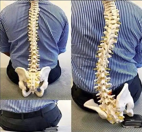 Đừng bao giờ đặt ví dưới mông