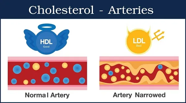 Giảm LDL và tăng HDL sẽ tốt hơn và tối ưu cho cơ thể của mọi người Giảm LDL và tăng HDL sẽ tốt hơn và tối ưu cho cơ thể của mọi người