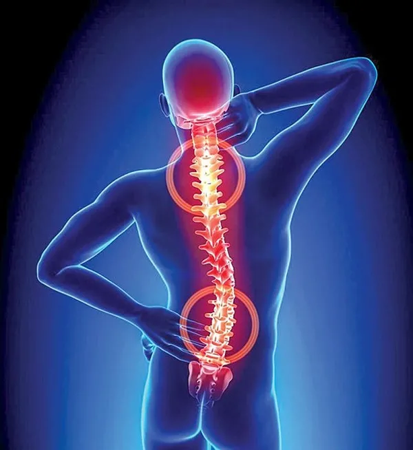 Giảm nguy cơ đau cột sống do thói quen hằng ngày Giảm nguy cơ đau cột sống do thói quen hằng ngày