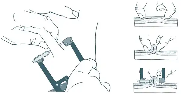 Kẹp đo mỡ có chức năng là kẹp đo mỡ Kẹp đo mỡ có chức năng là kẹp đo mỡ