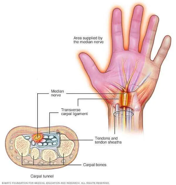 Nghĩ tập ngoài lịch tập vì chấn thương