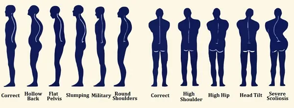 Nhận biết tư thế đúng khi cơ thể cân đối 2 bên