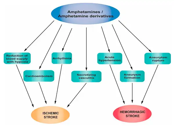 Steroid và chứng đột quỵ