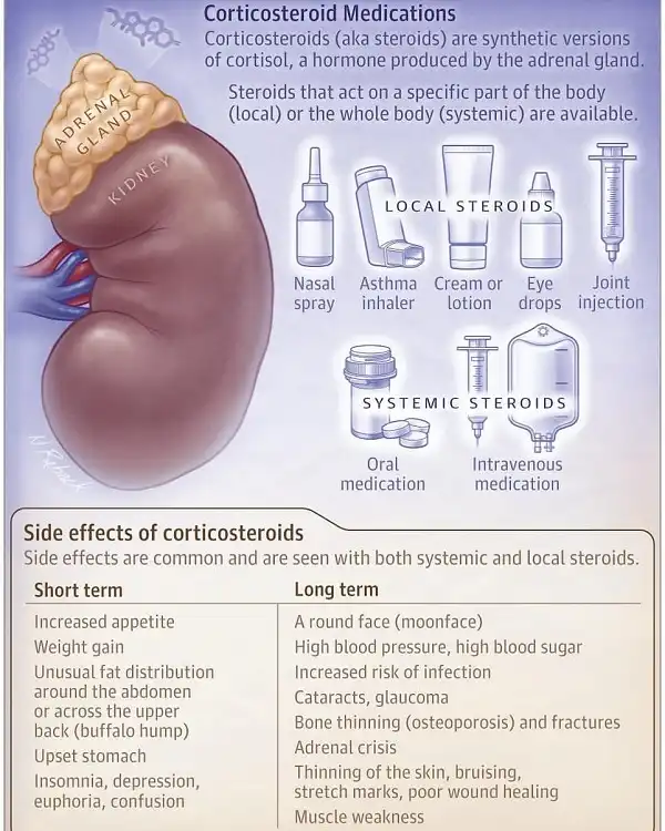 Tác dụng phụ của Steroid