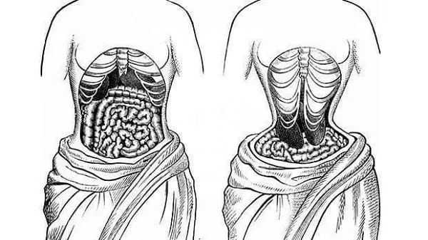 Tác hại khi dùng đai lưng Corset lên cơ thể nữ giới Tác hại khi dùng đai lưng Corset lên cơ thể nữ giới