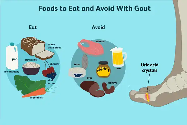 Thực phẩm cần tránh né hoặc được ăn khi bị Gout