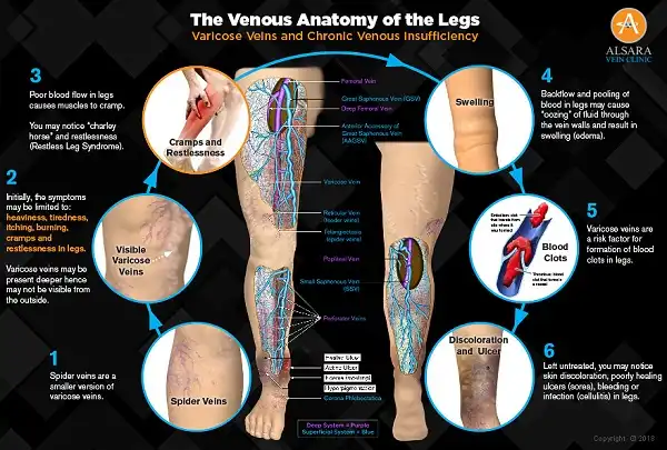 Thường xuyên bị chuột rút là do thiếu chất gì