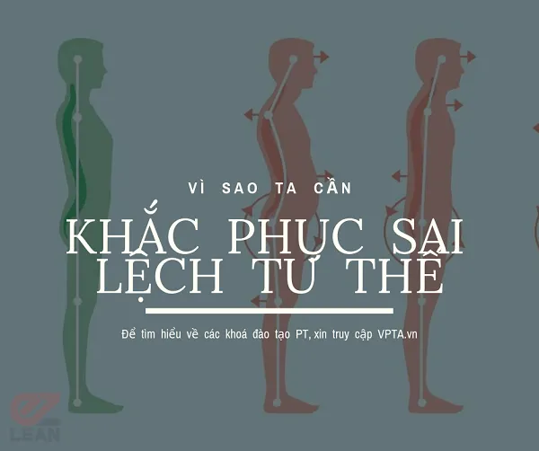 Vì sao cần khắc phục sai lệch tư thế Vì sao cần khắc phục sai lệch tư thế